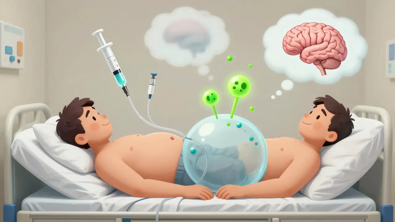 Patient avec ascite visible, un drain et un shunt TIPS flottants, tandis que des toxines atteignent son cerveau en nuages troubles.